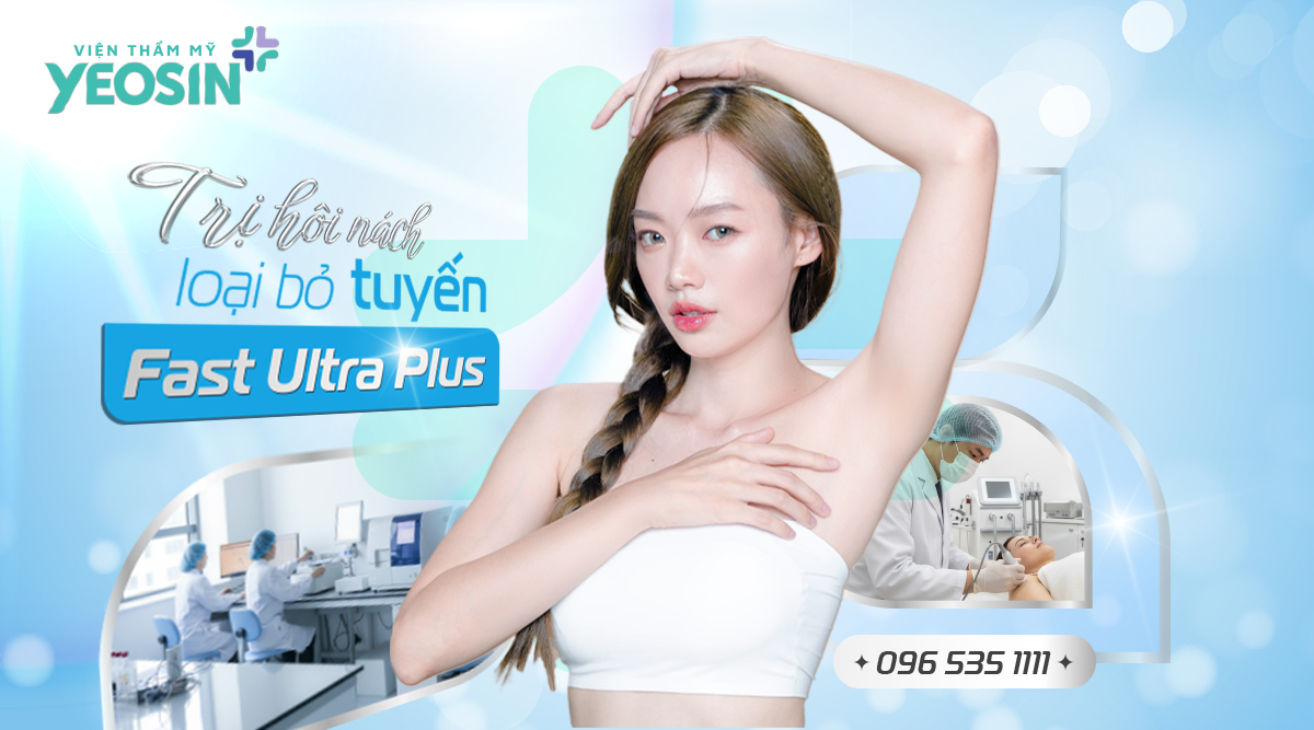 Trị hôi nách loại bỏ tuyến