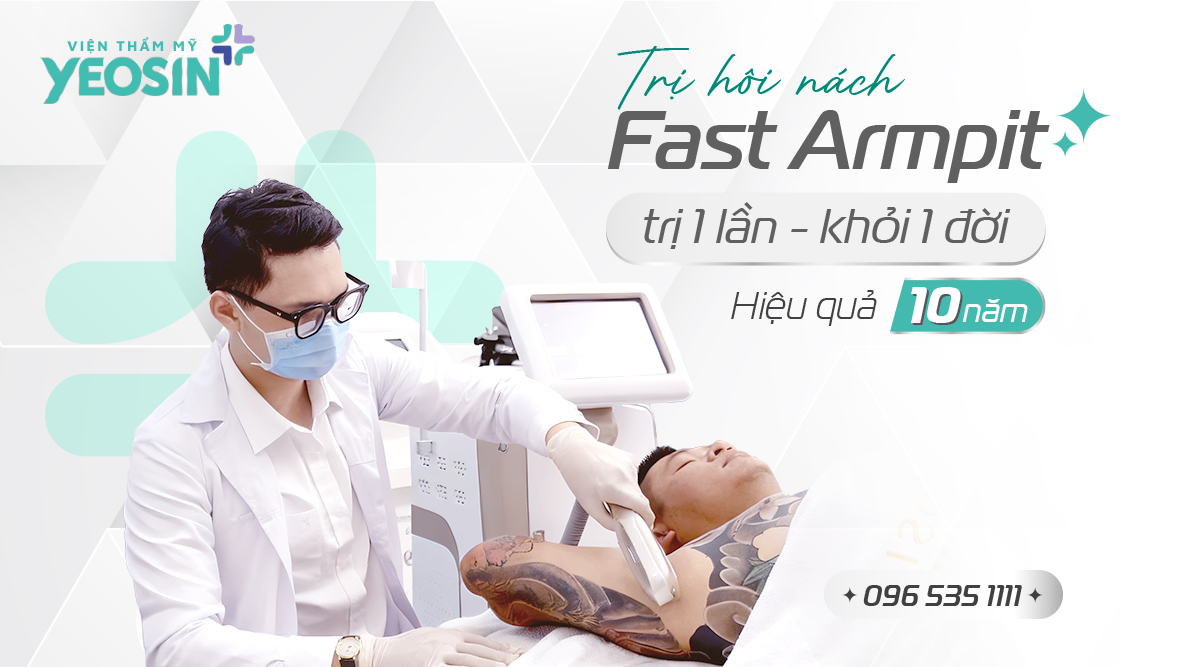 Trị hôi nách fast armpit