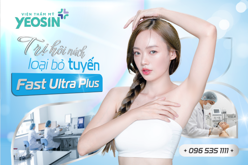 trị hôi nách loại bỏ tuyến