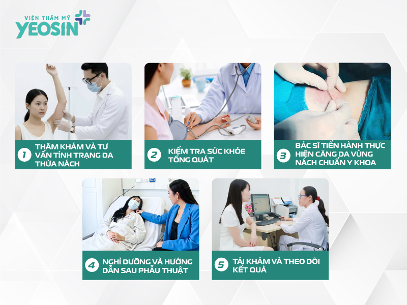 Quy trình thực hiện căng da nách loại bỏ da thừa chảy xệ