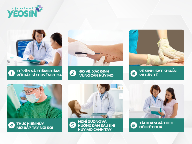 Quy trình hút mỡ vùng bắp tay bằng phương pháp nội soi