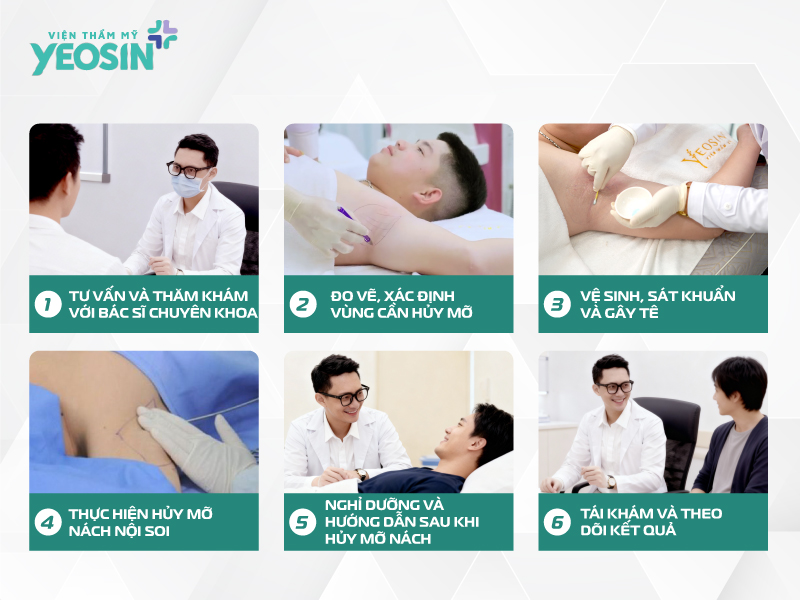 Quy trình hút mỡ vùng nách bằng phương pháp nội soi