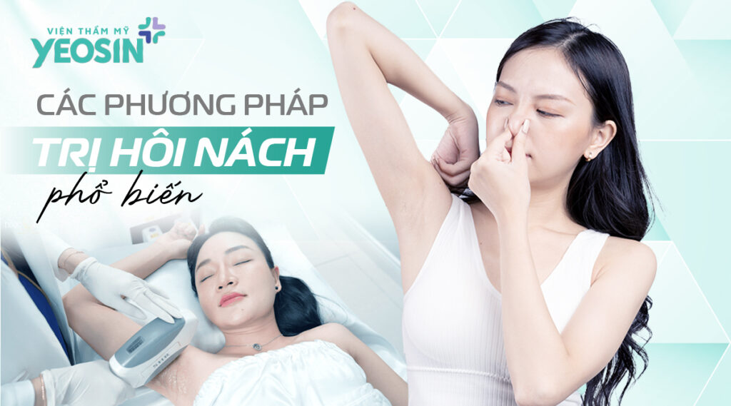 Các phương pháp trị hôi nách phổ biến hiện nay