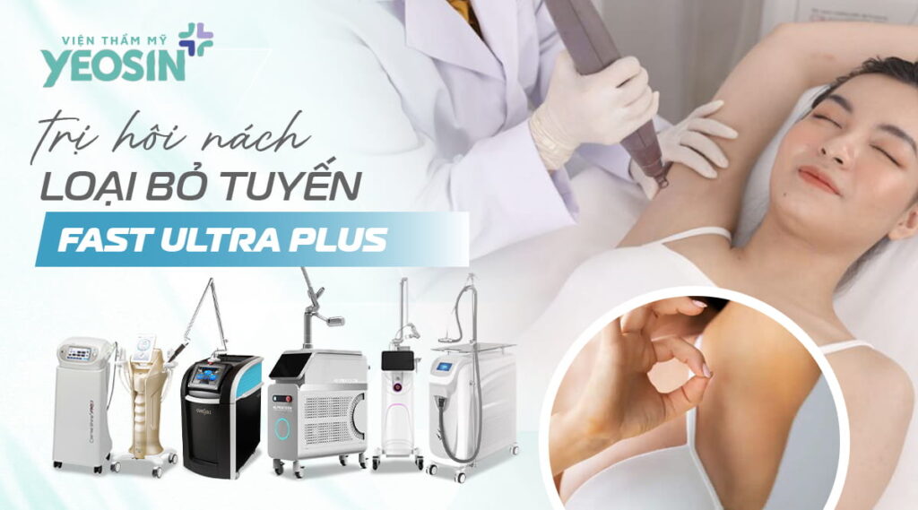 trị hôi nách bằng loại bỏ tuyến mồ hôi công nghệ Fast Ultra Plus