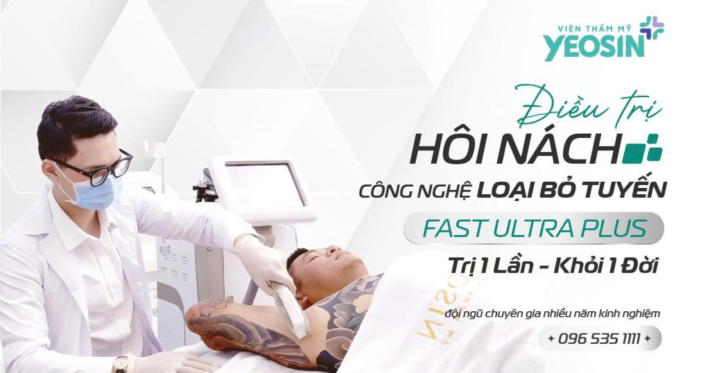 Ưu điểm vượt trội của công nghệ điều trị hôi nách bằng loại bỏ tuyến