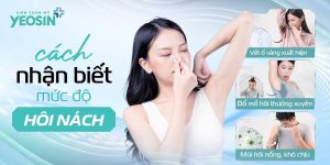Cách nhận biết mức độ hôi nách