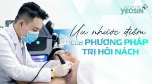 Ưu nhược điểm của phương pháp trị hôi nách