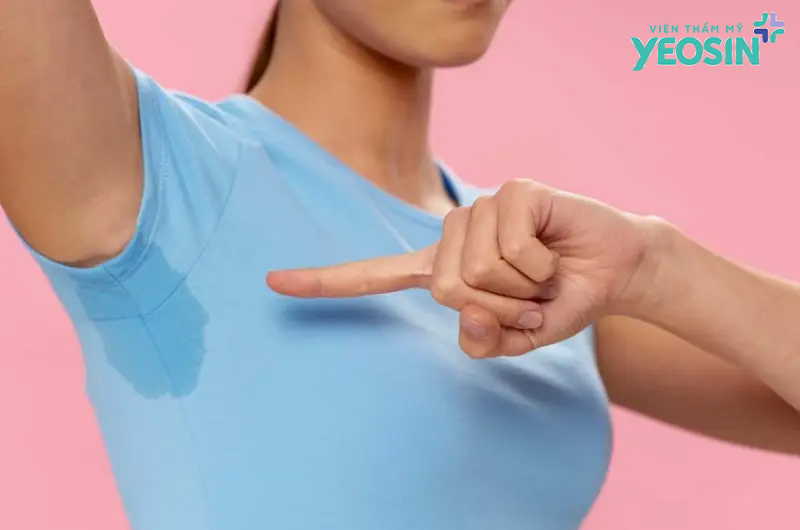 Bệnh hôi nách có lây không? Yeosin Bệnh hôi nách có lây không? Hôi nách có bị di truyền không