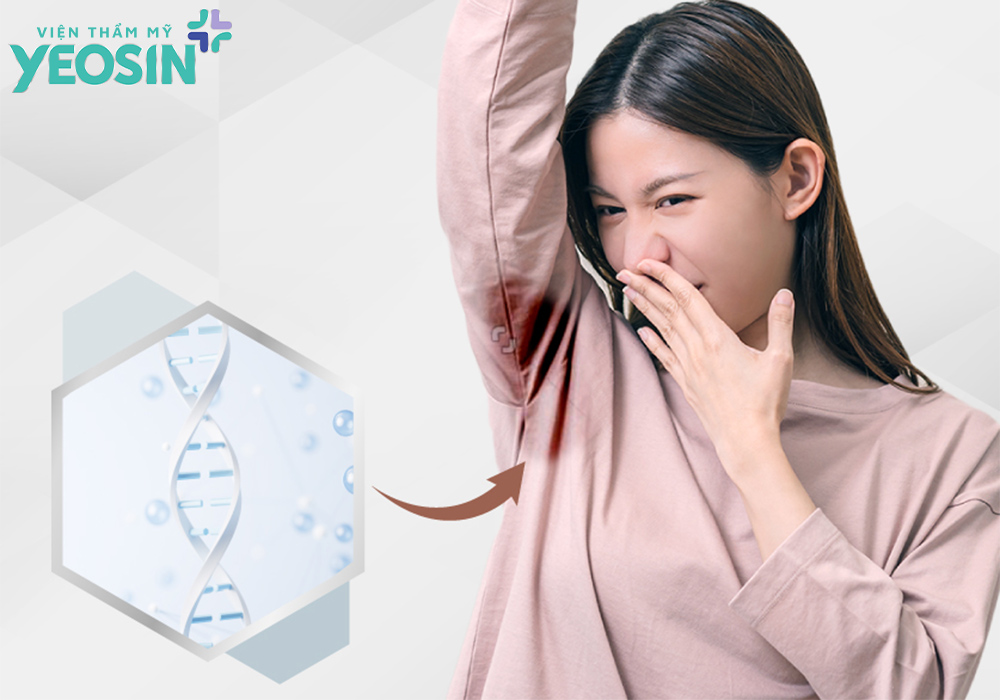 Nguyên nhân gây hôi nách Yeosin Di truyền cũng là nguyên nhân gây hôi nách
